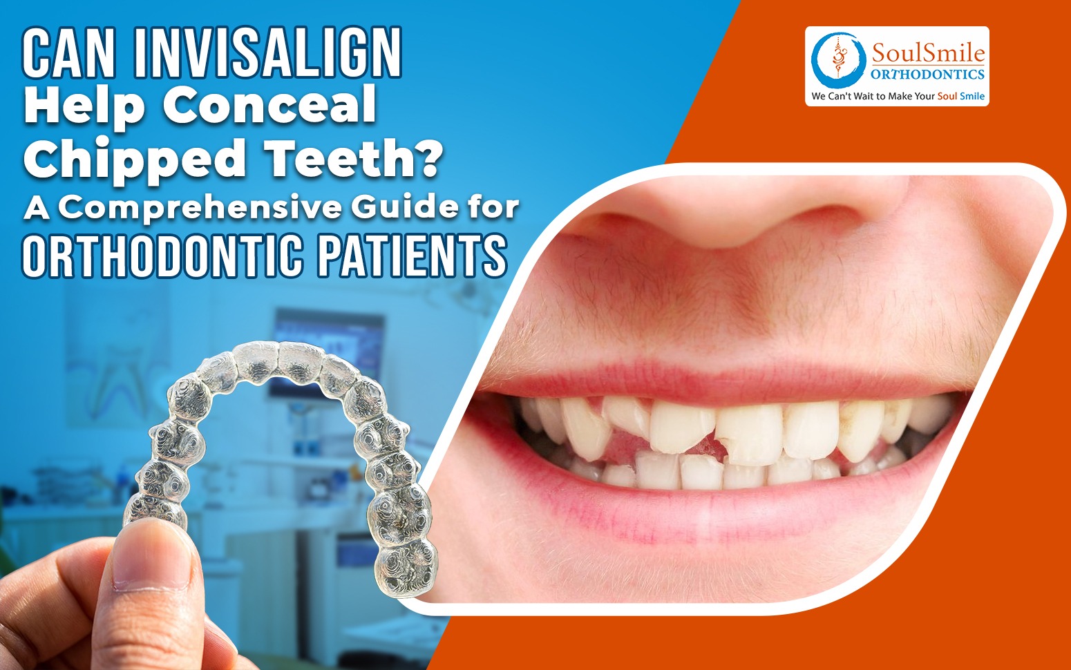 What Is Invisalign and How Does It Work?