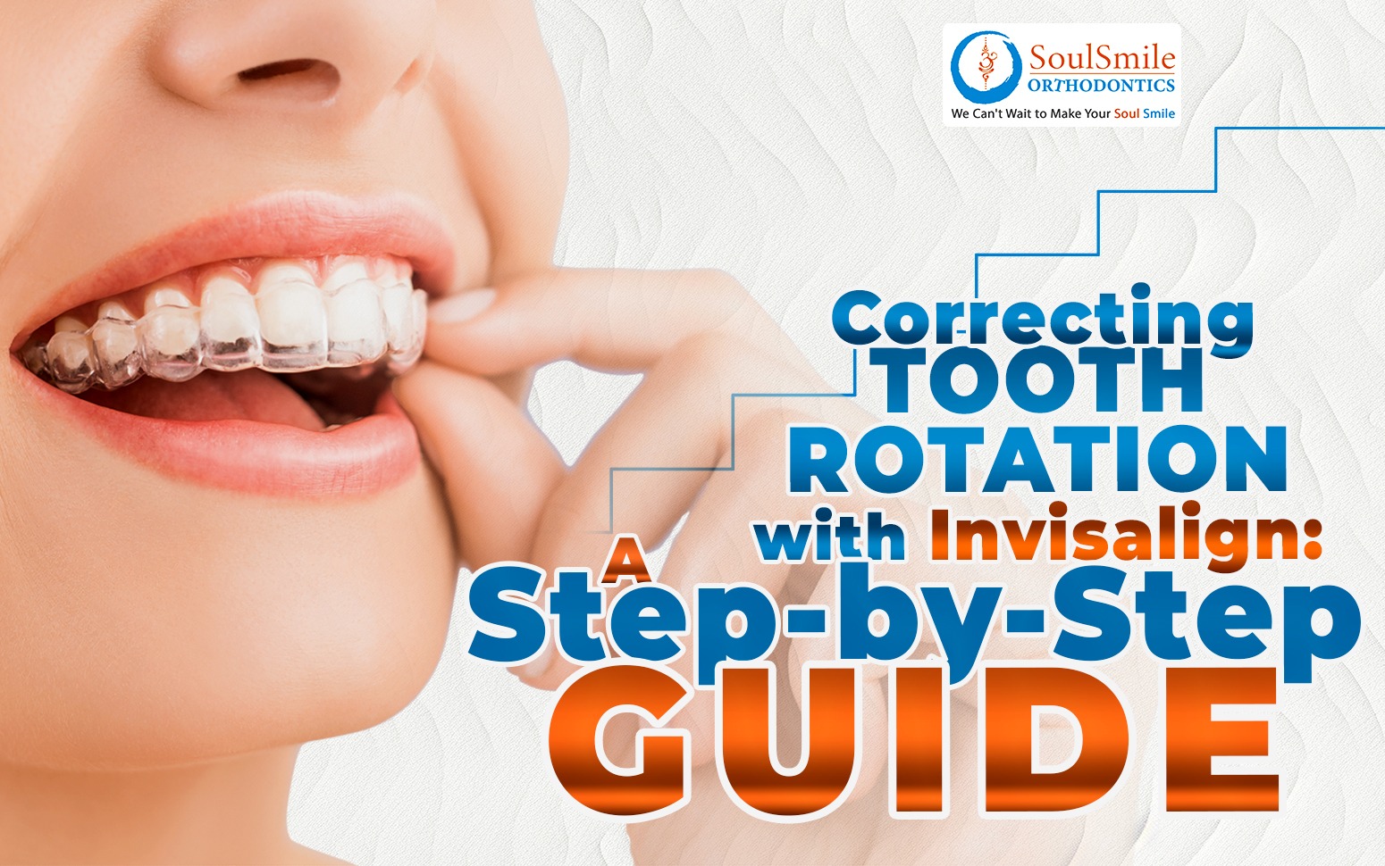 Correcting Tooth Rotation with Invisalign