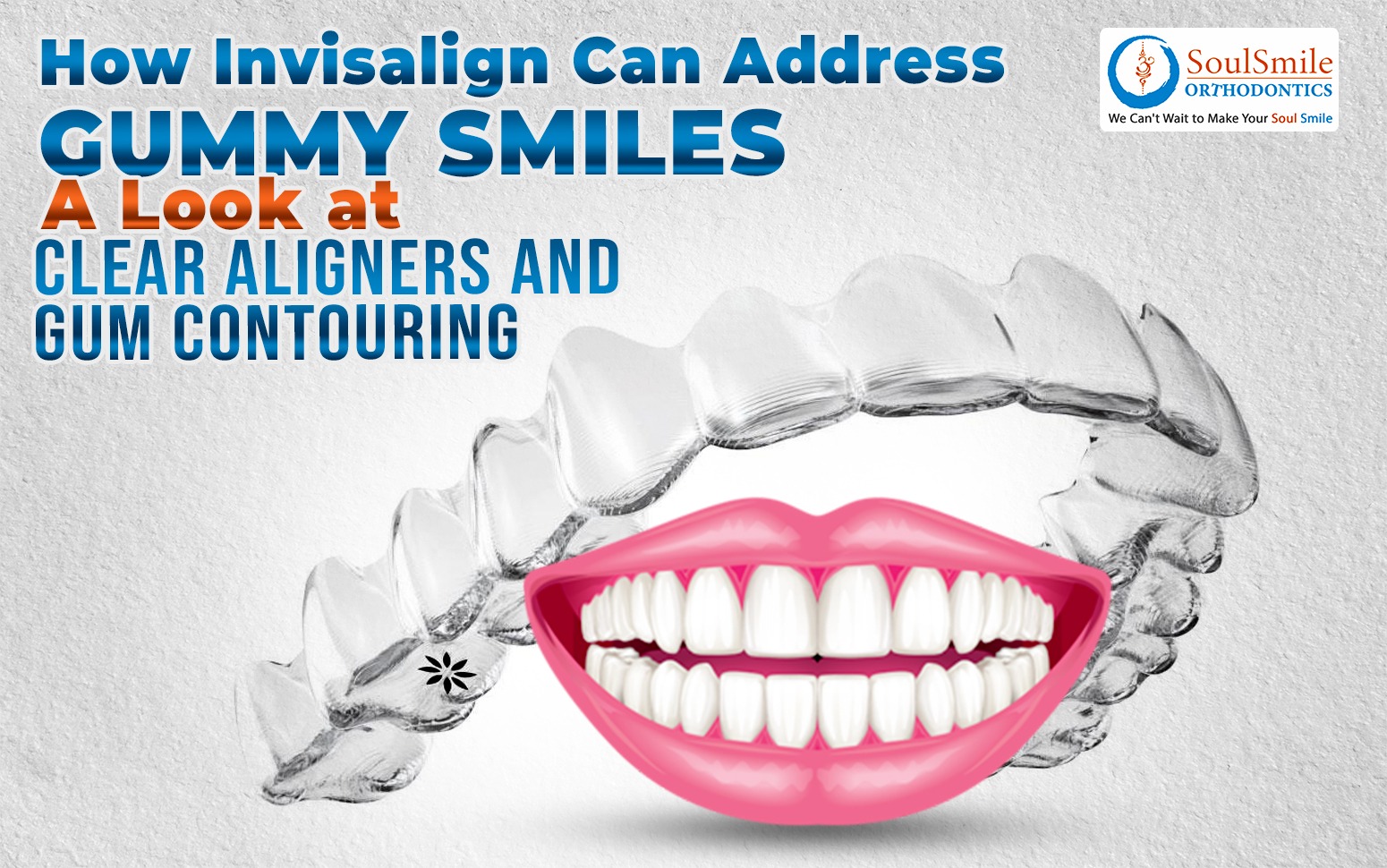 Clear Aligners and Gum Contouring