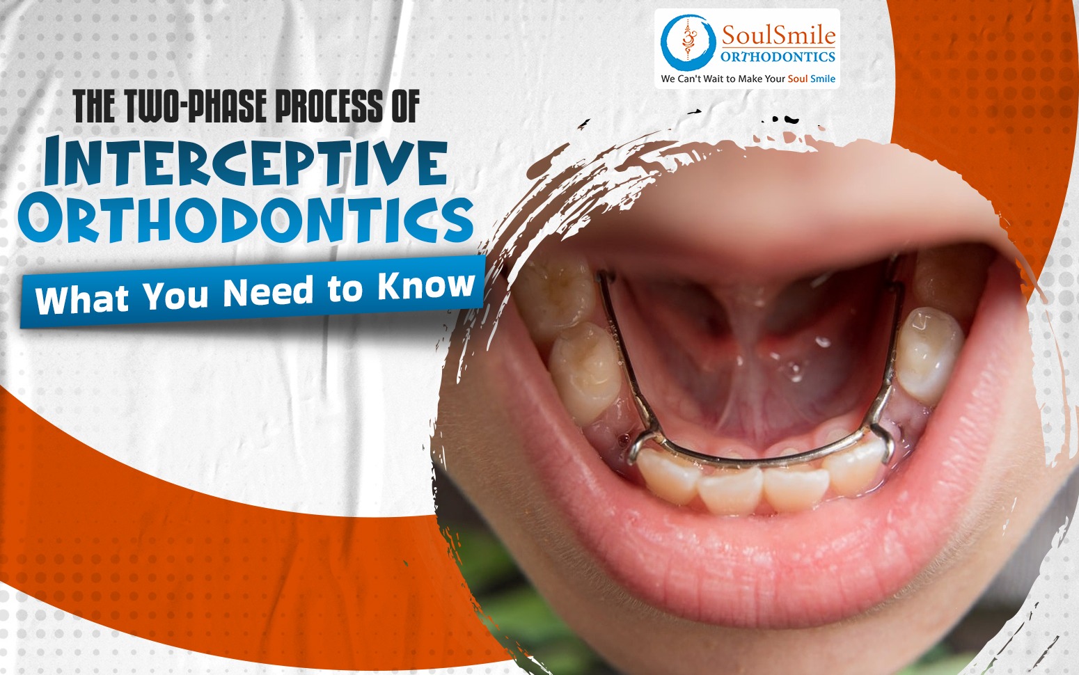 What Is Interceptive Orthodontics?